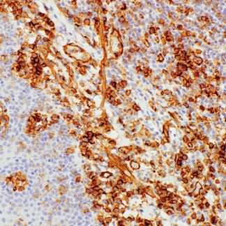 CD31 Antibody (Immunohistochemistry)