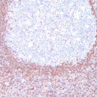 Bcl-2 Antibody (Immunohistochemistry)