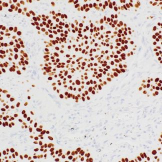 p40 Antibody (Immunohistochemistry)