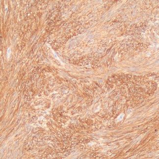 DOG-1 Antibody (Immunohistochemistry)