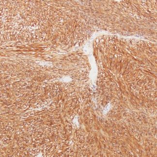 CD117 (c-Kit) Antibody (Immunohistochemistry)