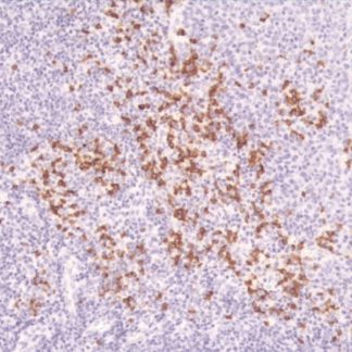 Kappa Light Chain Antibody (Immunohistochemistry)