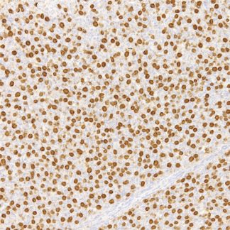 CD5 Antibody (Immunohistochemistry)