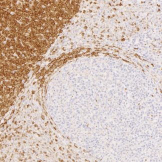 🇬🇧 GATA-3 Antibody (Immunohistochemistry)