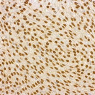 MLH1 Antibody (Immunohistochemistry)