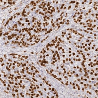 MSH6 Antibody (Immunohistochemistry)