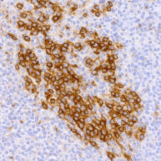 PD-L1 Rabbit Monoclonal Antibody - 6ml