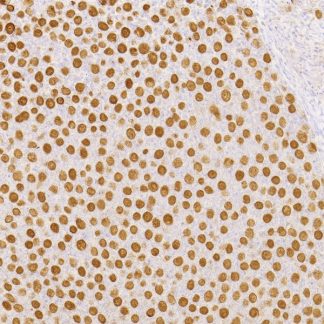 SATB-2 Antibody (Immunohistochemistry)
