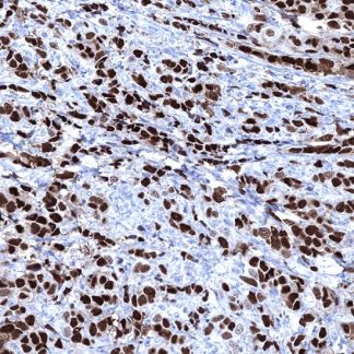 Progesterone Receptor (PR) Antibody (Immunohistochemistry)