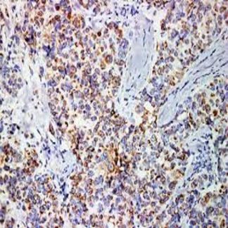 Mammaglobin Antibody (Immunohistochemistry)
