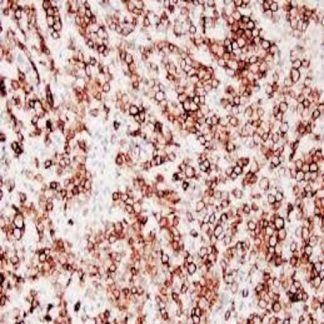 D2-40 Antibody (Immunohistochemistry)