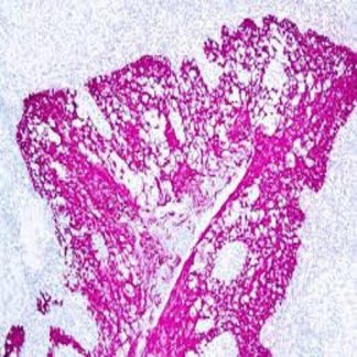 Cytokeratin (HMW) Antibody (Immunohistochemistry)