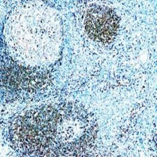 CD79a Antibody (Immunohistochemistry)