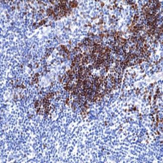 TdT Antibody (Immunohistochemistry)