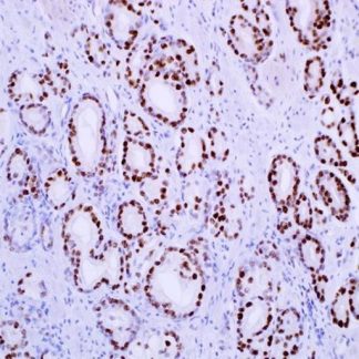 c-Myc Antibody (Immunohistochemistry)
