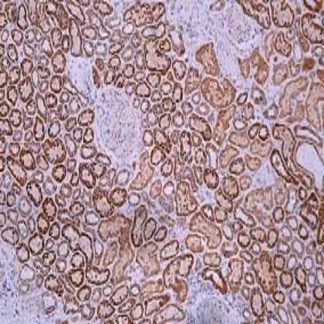 🇬🇧 PD-1 Antibody (Immunohistochemistry)