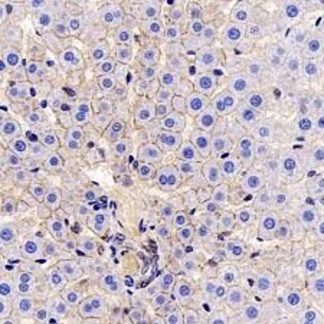 E-Cadherin Antibody (Immunohistochemistry)