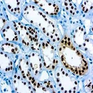 🇬🇧 PAX-8 Antibody (Immunohistochemistry)