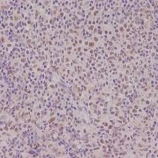 🇬🇧 PMS2 Antibody (Immunohistochemistry)