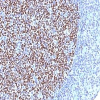 🇬🇧 Bcl-6 Antibody (Immunohistochemistry)