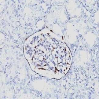 🇬🇧 WT-1 Antibody (Immunohistochemistry)