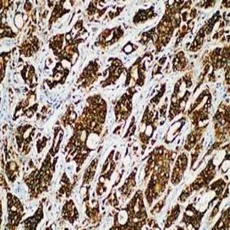 🇬🇧 AMACR / p504s Antibody (Immunohistochemistry)