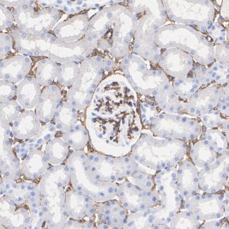 Caldesmon Antibody (Immunohistochemistry)
