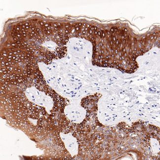 Cytokeratin (Pan) Antibody (Immunohistochemistry)