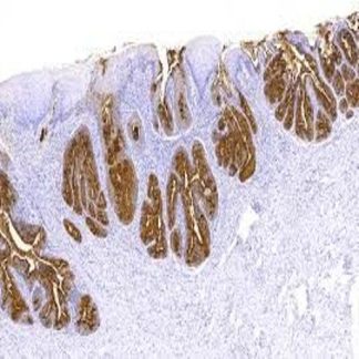 CA 125 Antibody Immunohistochemistry (IHC)