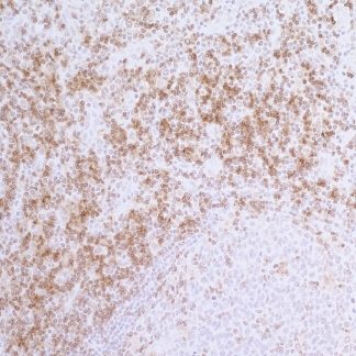 CD4 Antibody (Immunohistochemistry)
