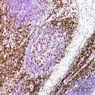 CD43 Antibody Immunohistochemistry (IHC)