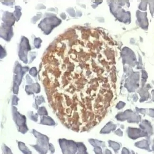 NSE Antibody (Immunohistochemistry)