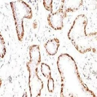 Calponin Antibody Immunohistochemistry (IHC)