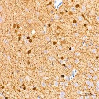 Calretinin Antibody Immunohistochemistry (IHC)