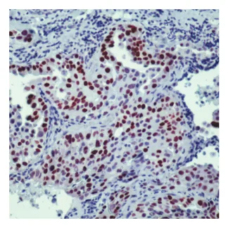 TTF-1 Antibody (Immunohistochemistry)