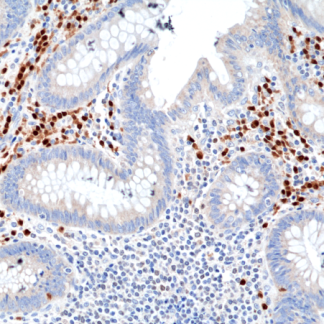 🇬🇧 MUM1 Antibody (Immunohistochemistry)