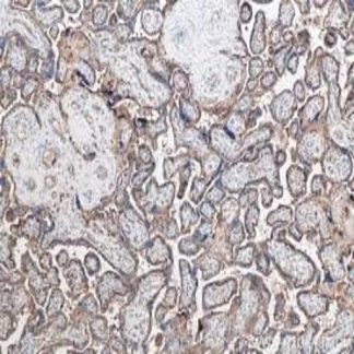 GLUT-1 Antibody Immunohistochemistry (IHC)