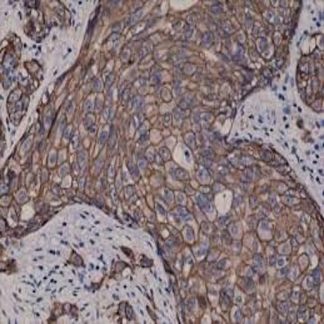 HER-2 Antibody Immunohistochemistry (IHC)