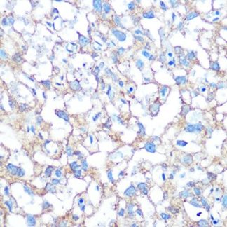 PLAP Antibody (Immunohistochemistry)