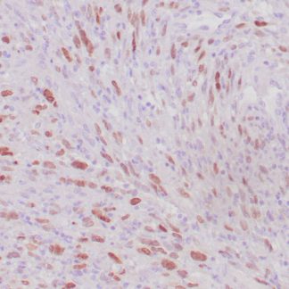 🇬🇧 MyoD1 Antibody (Immunohistochemistry)