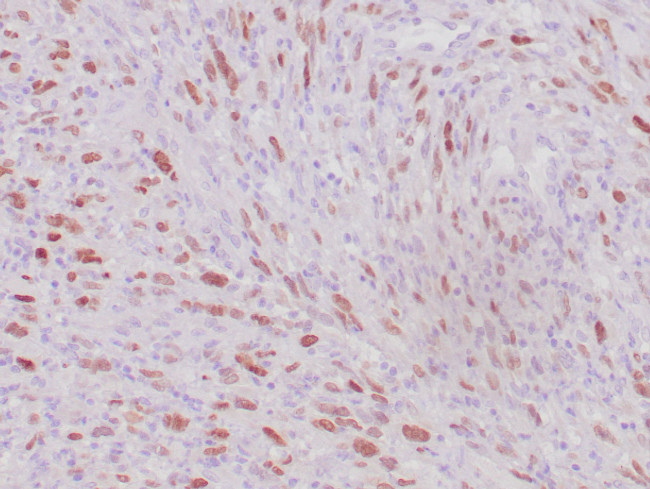 🇬🇧 MyoD1 Antibody (Immunohistochemistry)