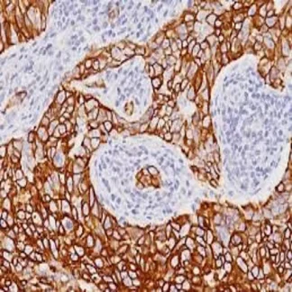 🇬🇧 Cytokeratin 7 Antibody (Immunohistochemistry)