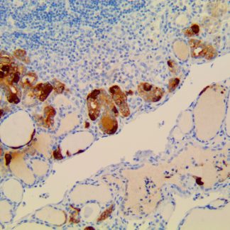 Calcitonin Antibody (Immunohistochemistry)