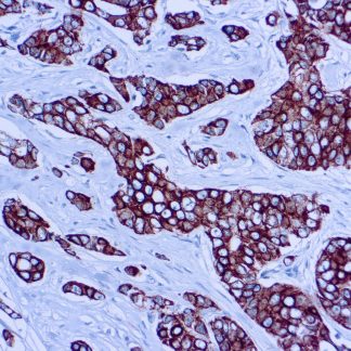 CAM5.2 Antibody Immunohistochemistry (IHC)