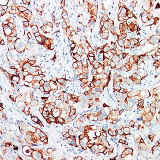 🇬🇧 GCDFP-15 Antibody (Immunohistochemistry)