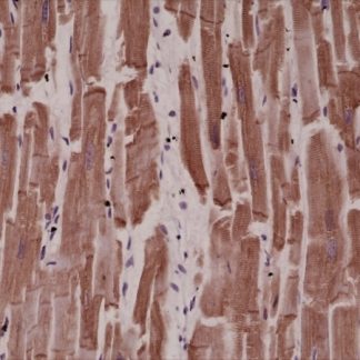 Desmin Antibody Immunohistochemistry (IHC)