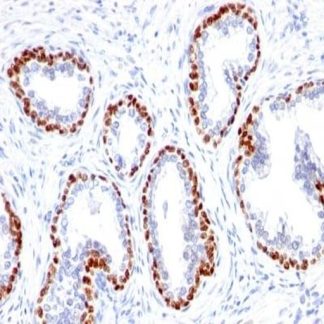 p63 Antibody Immunohistochemistry (IHC)