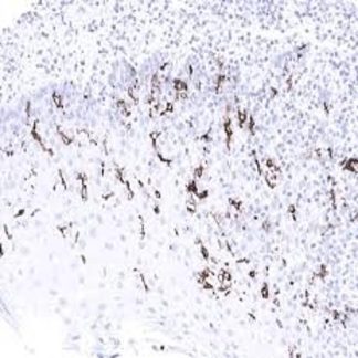CD1a Antibody (Immunohistochemistry)