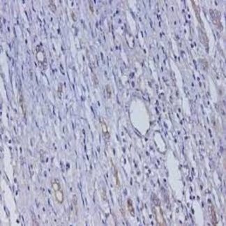 AFP (Alpha-Fetoprotein) Antibody (Immunohistochemistry)