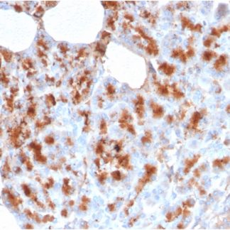 MDM2 Antibody (Immunohistochemistry)